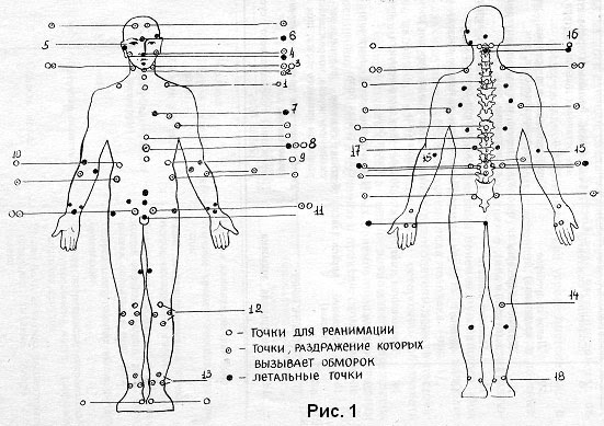 Самые места человека. Акупунктура тела человека схема болевые точки. Болевые точки у человека на теле схема. Болевые точки у человека нажать. Смертельные акупунктурные точки.