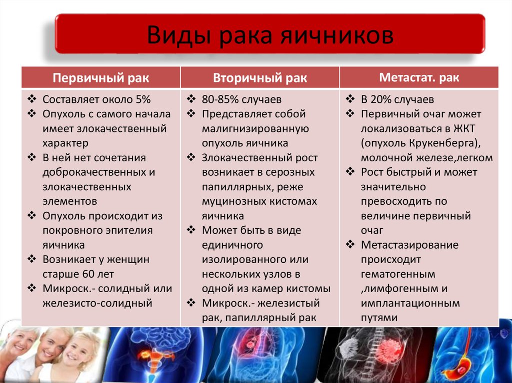 Признаки яичников. Злокачественные опухоли яичников. Клинические симптомы опухолей яичника. Онкология яичника симптомы. Клинические симптомы опухоли яичников.