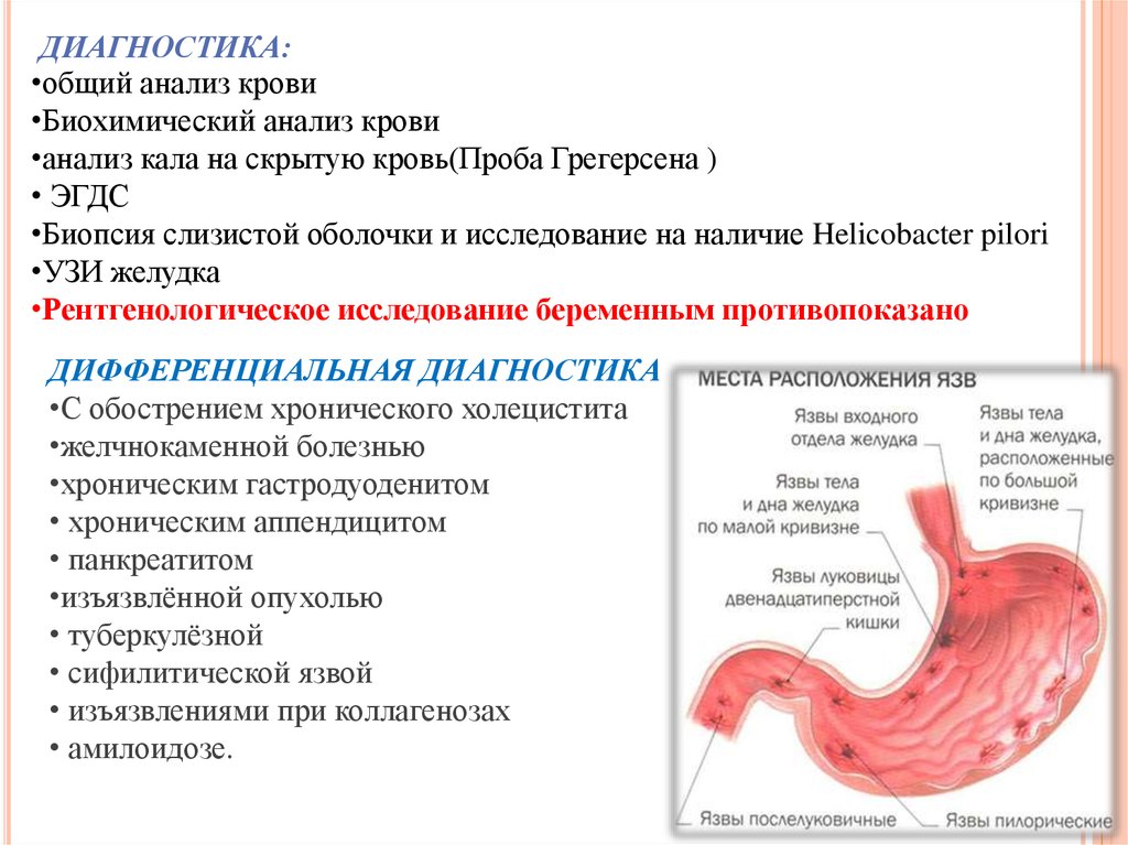 Клиническая картина язвенной болезни желудка и двенадцатиперстной кишки