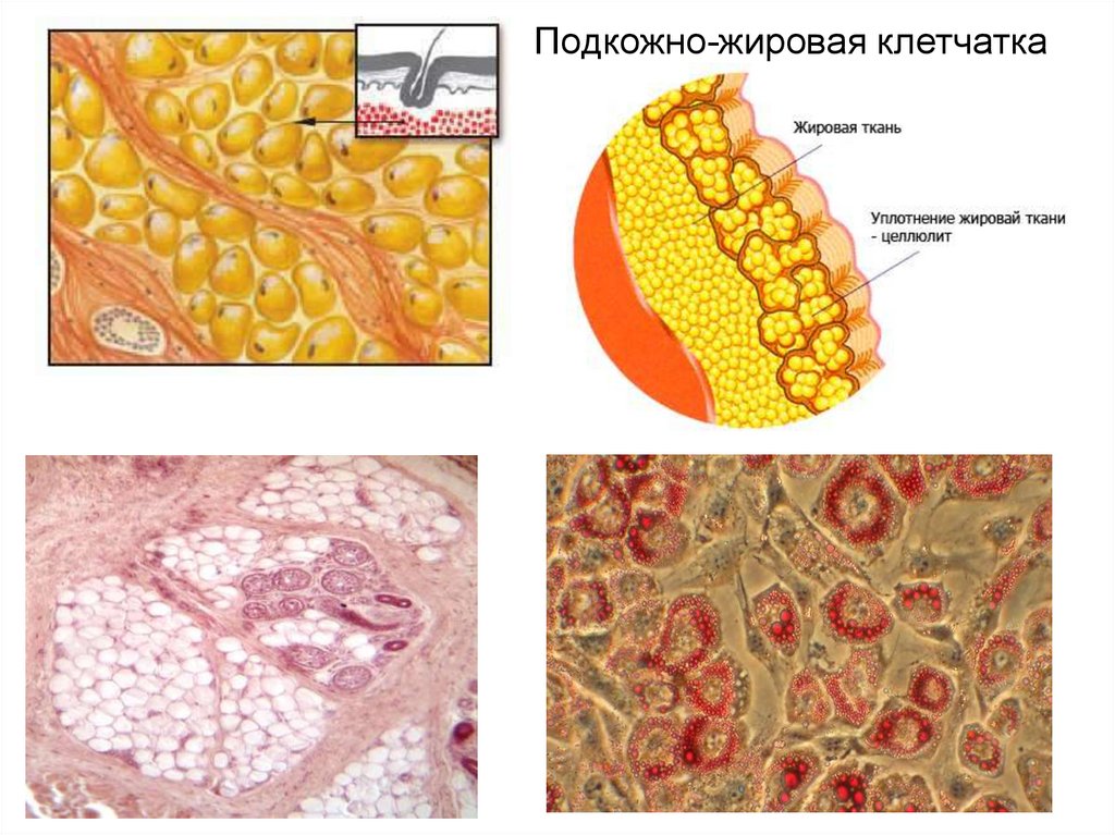 Подкожно жировая клетчатка это