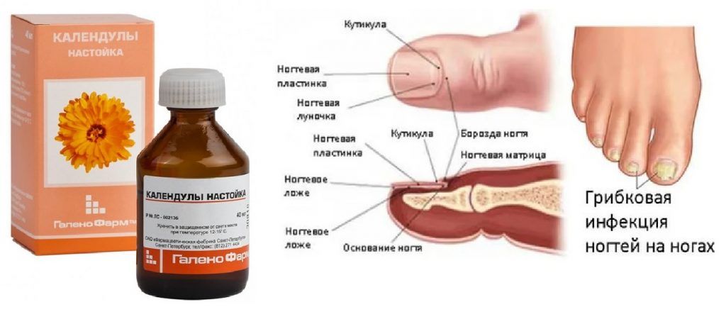 Схема лечения грибка кожи