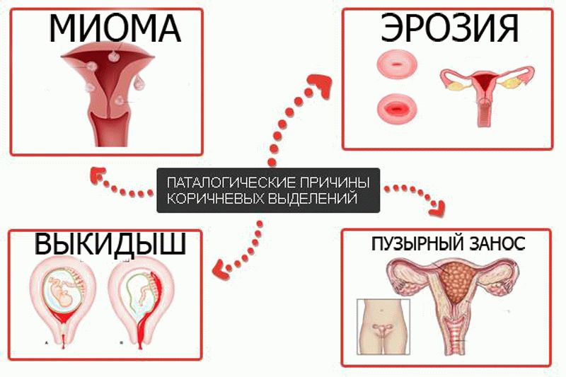 Откуда выходят месячные схема