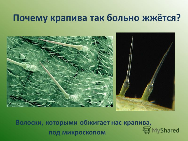Зачем крапива. Трихомы крапивы под микроскопом. Железистые трихомы крапивы. Жгучий волосок крапивы под микроскопом. Иглы крапивы.