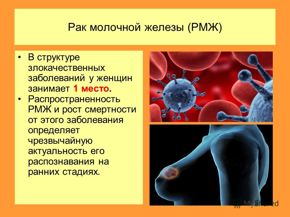 Рак онкология презентация