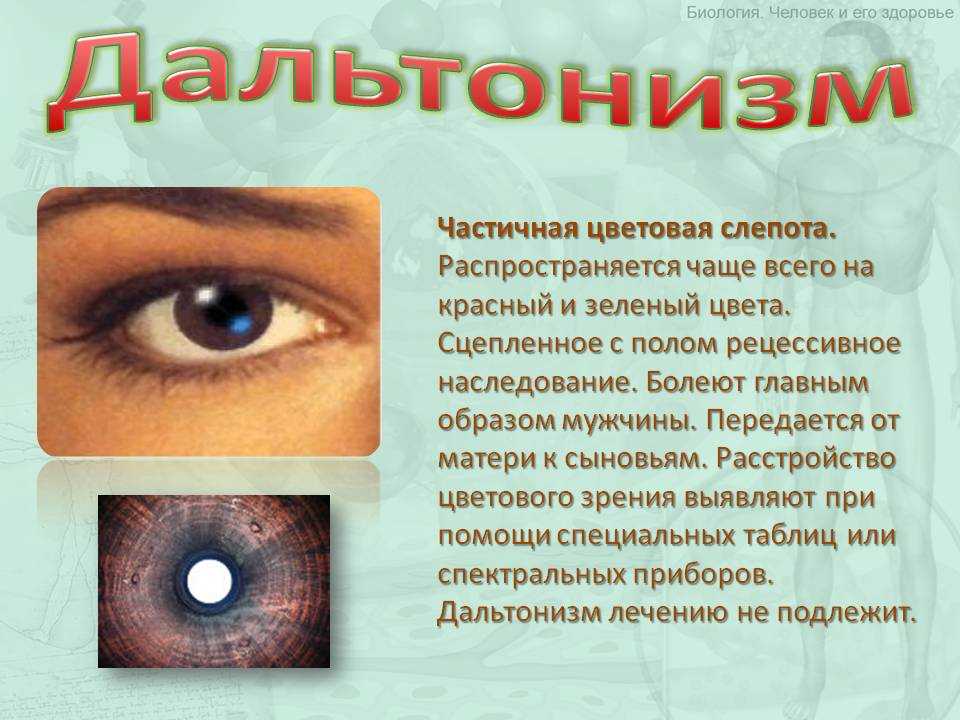 Заболевания глаз биология 8 класс. Заболевания глаз со слепотой. Заболевание глаз с описанием. Частичная потеря зрения.