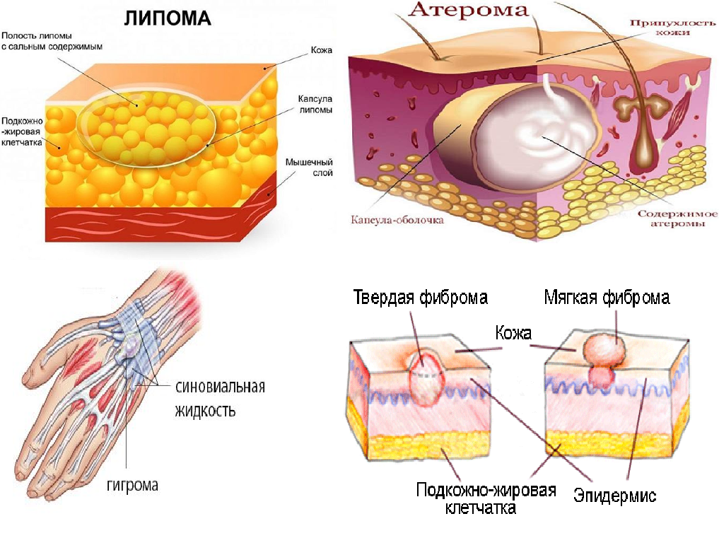 Как на коже выдавить рисунок