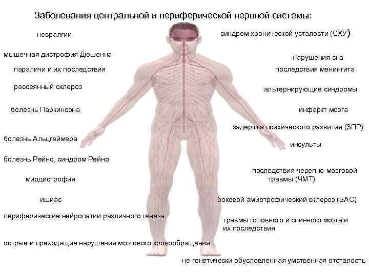 Заболевание нервной системы презентация