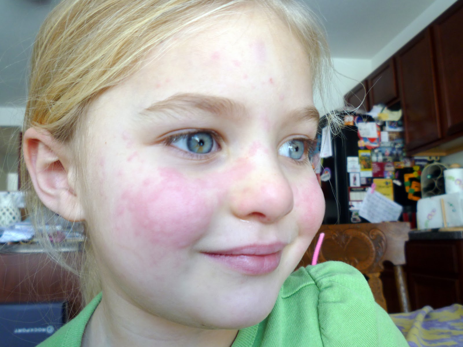 аллергия на старый диван
