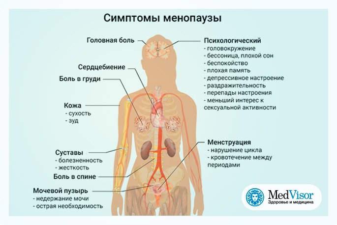 Признаки климакса после 40 начинающегося у женщин. Климаксы у женщин симптомы. Менопауза-симптомы. Первые симптомы климакса у женщин. Признаки менопаузы у женщин.