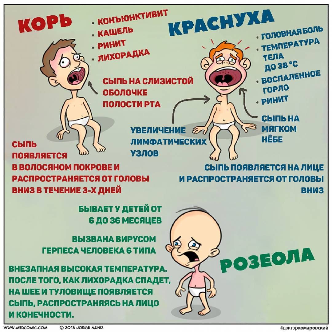 Корь симптомы и лечение у детей информация для родителей картинки