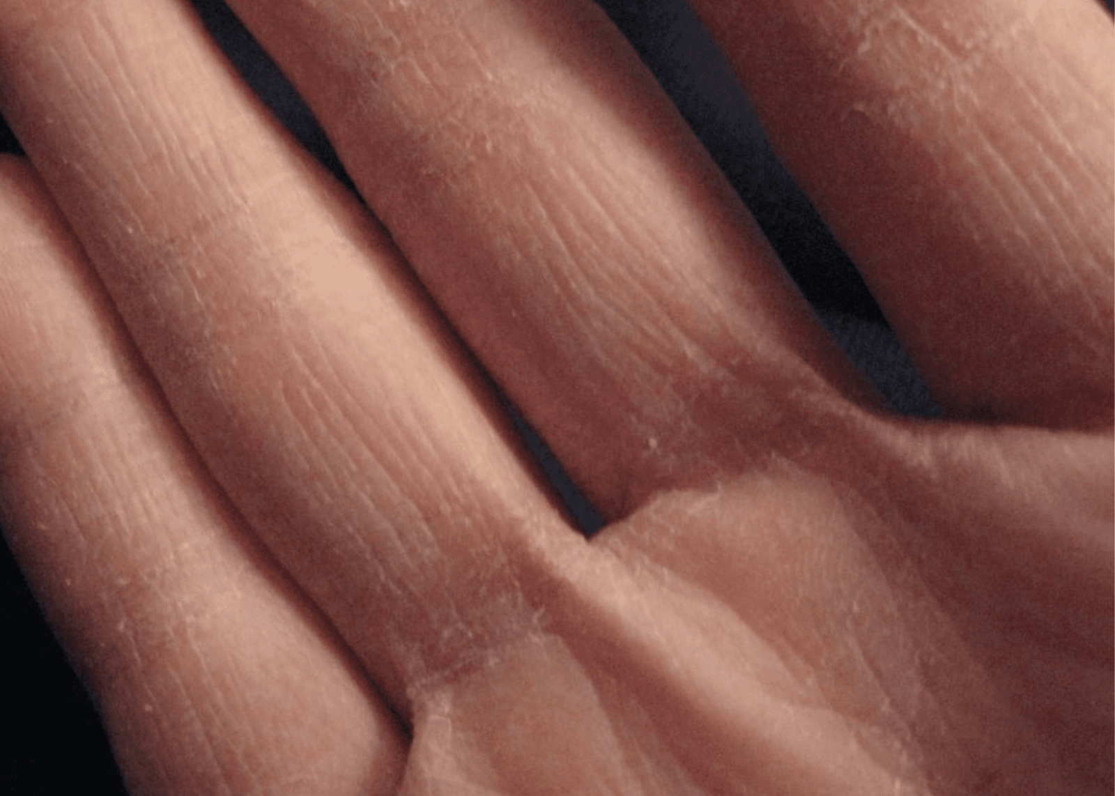 Почему пальцы темные