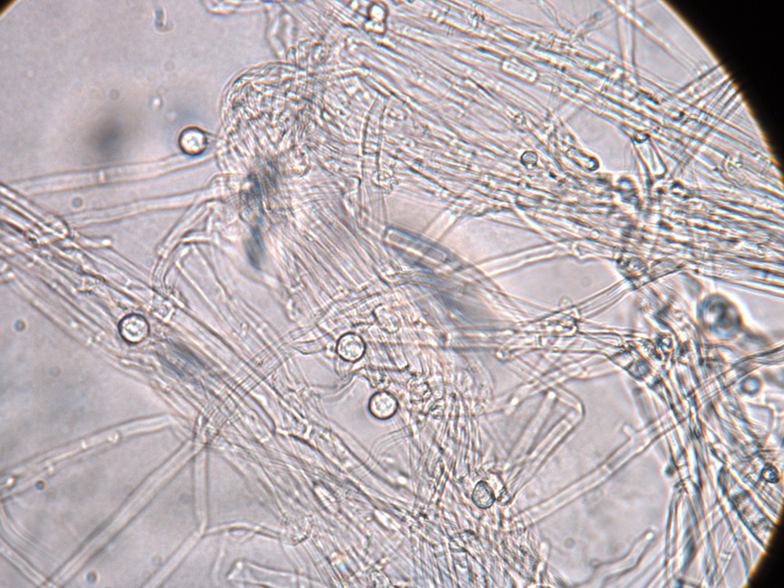 Нити мицелия споры. Фузариум микроскопия. Мицелий Fusarium под микроскопом. Грибы Fusarium. Фузариум мицелий.