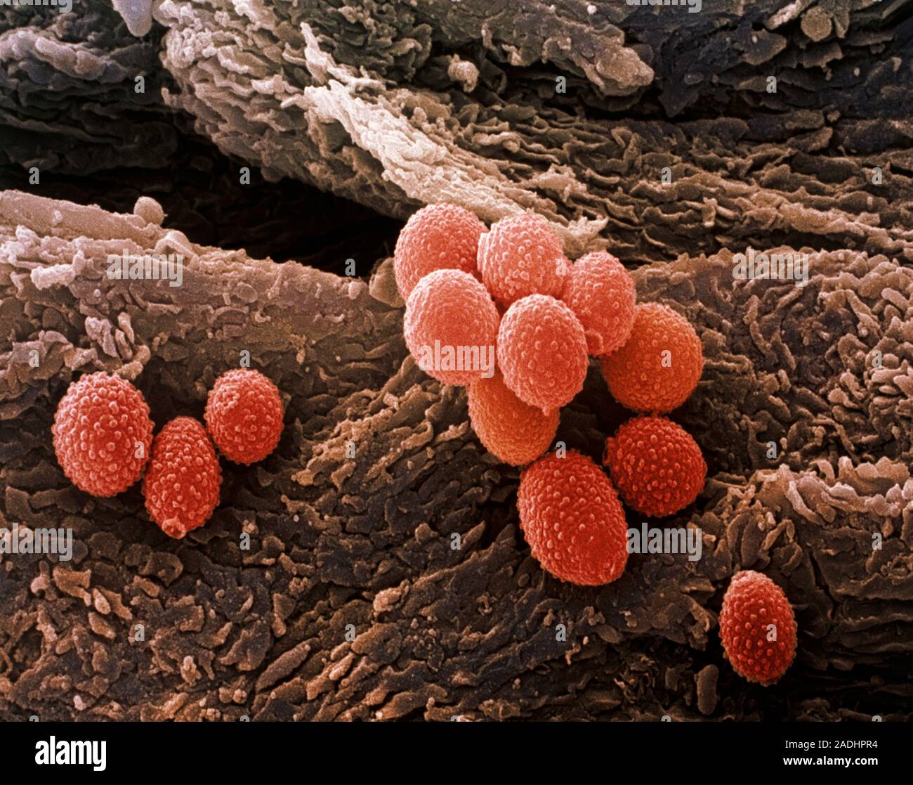 На коже обнаружены споры. Микоз стопы под микроскопом. Грибок ногтей под микроскопом. Грибы кожи под микроскопом. Грибок кожи под микроскопом.
