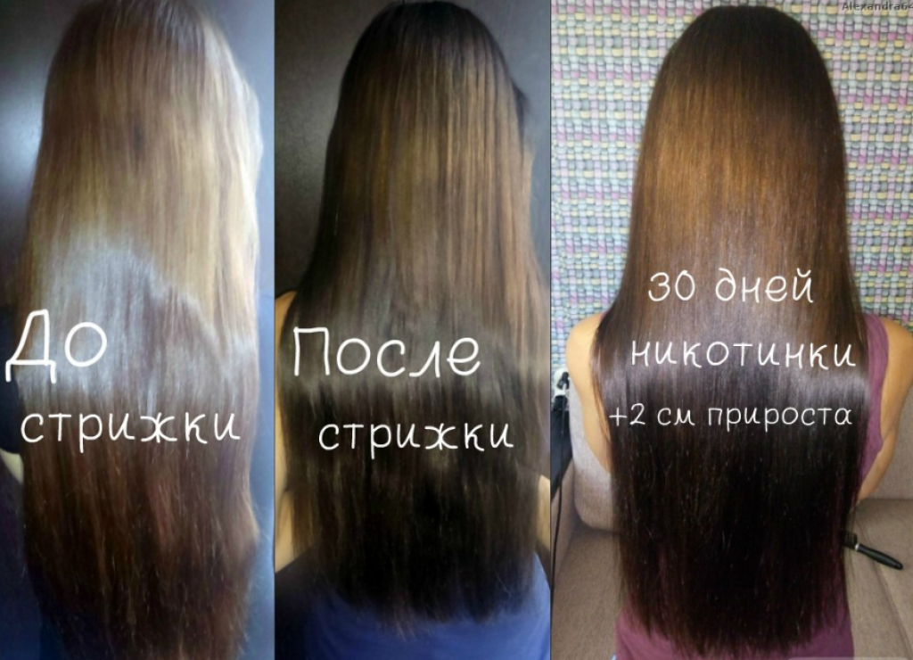 Отзывы рост волос на голове. Никотиновая кислота для волос. Никотиновая кислота для волос рост волос. Волосы после никотиновой кислоты. Никотиновая кислота для волос до и после.